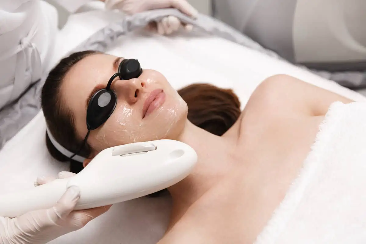 MOXI Fractionated Laser by The Natural Aesthetic Medspa in Sykesville, MD