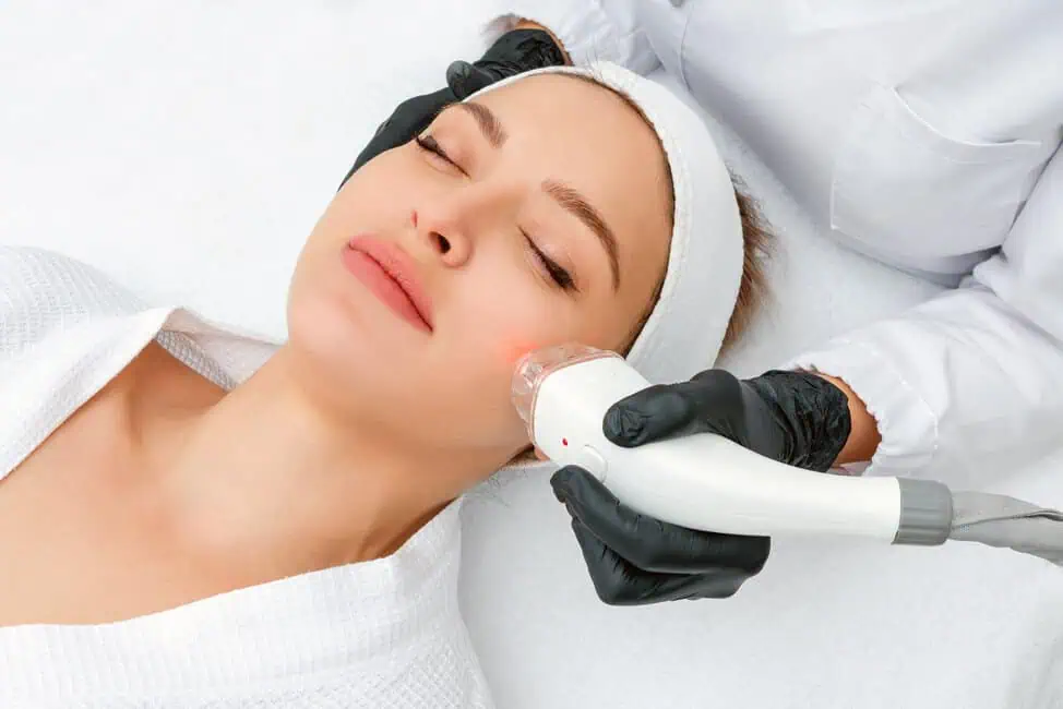 Facial Laser Treatments by The Natural Aesthetic Medspa, LLC in Sykesville, MD