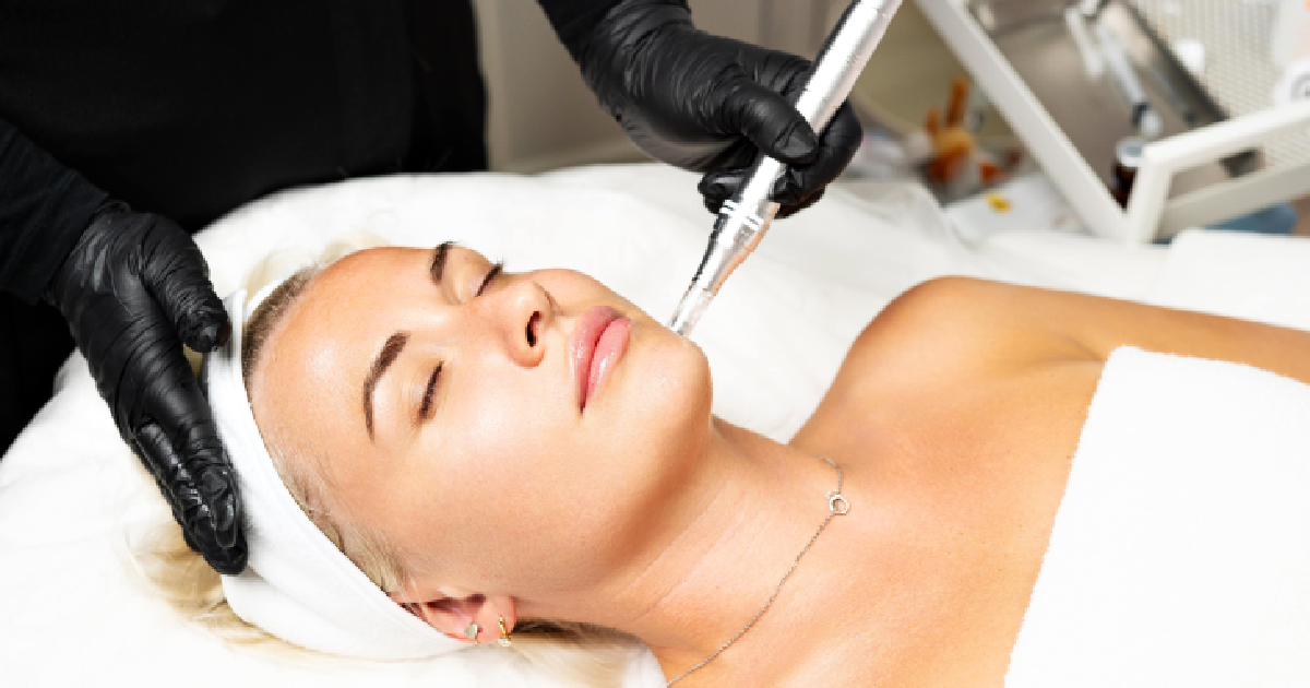 Woman receiving a microneedling treatment on her chin in Sykesville MD